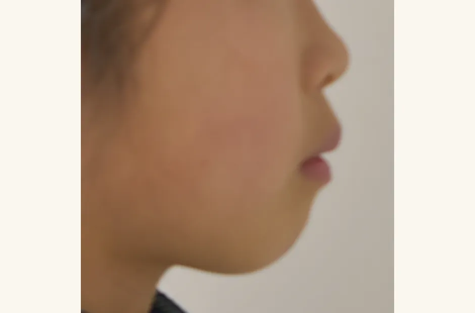 治療前