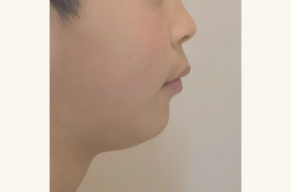 治療中
