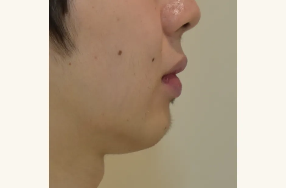治療後