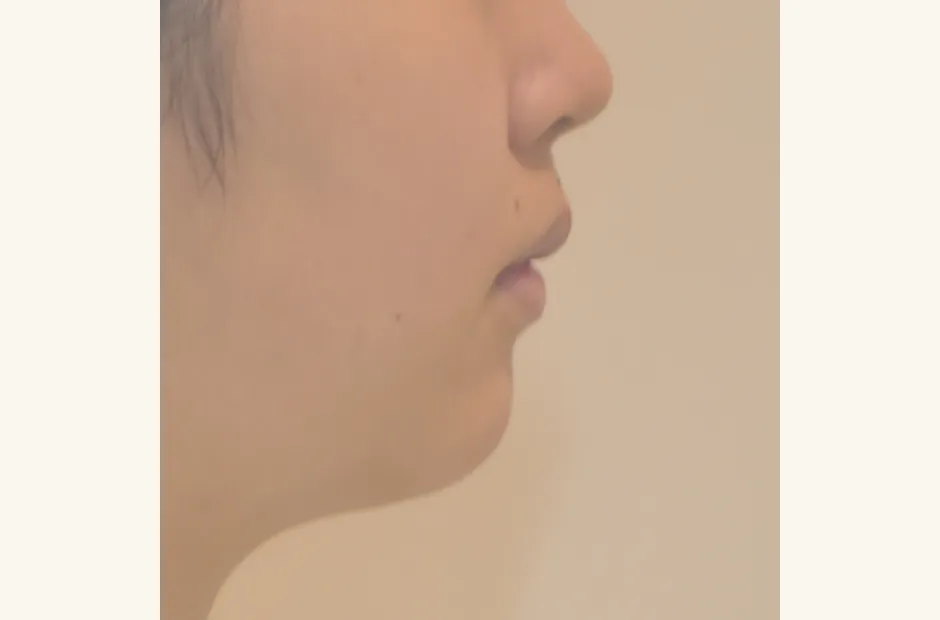 治療後