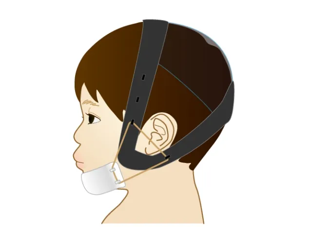 歯列矯正用チンキャップ
