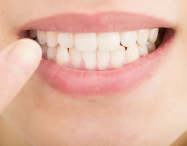 歯の表面に傷がつきにくい