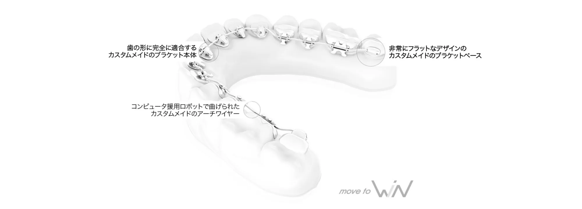 デジタル技術を用いた精密な裏側矯正