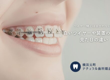 ワイヤー矯正は目立たない?白いワイヤーや装置の種類と見た目の違い