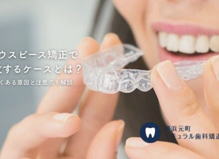 マウスピース矯正で失敗するケースとは?よくある原因と注意点を解説