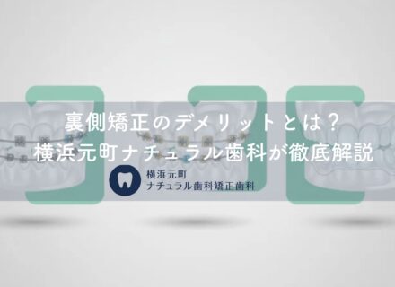 裏側矯正のデメリットとは?横浜元町ナチュラル歯科が徹底解説