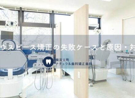 マウスピース矯正の失敗ケースと原因・対策｜横浜元町ナチュラル歯科 矯正歯科