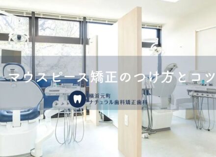 マウスピース矯正のつけ方とコツ｜横浜元町ナチュラル歯科が徹底解説