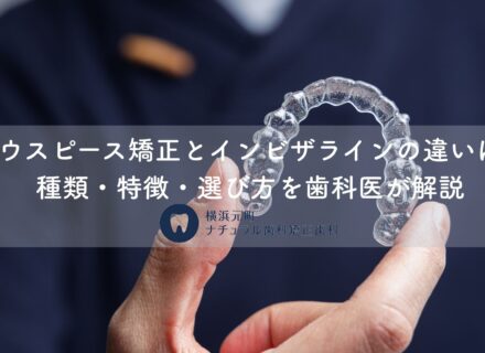 マウスピース矯正とインビザラインの違いは？種類・特徴・選び方を歯科医が解説