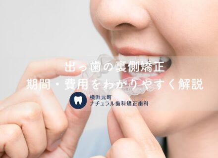 出っ歯の裏側矯正|期間・費用をわかりやすく解説【横浜元町ナチュラル歯科】
