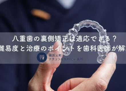 八重歯の裏側矯正は適応できる?難易度と治療のポイントを歯科医師が解説